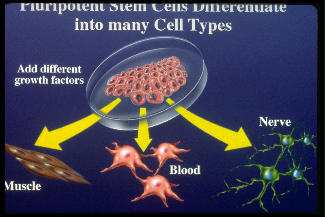 Stem Cell Therapy (Terapi Sel Induk) Pada Autisme || Autisme ABA Applied Behavior Analysis Lovaas KID-ABA Autism Center Indonesia Jakarta Bekasi